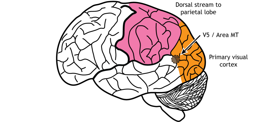 Illustration of the brain showing area MT near the occipital lobe, temporal lobe, parietal lobe junction.