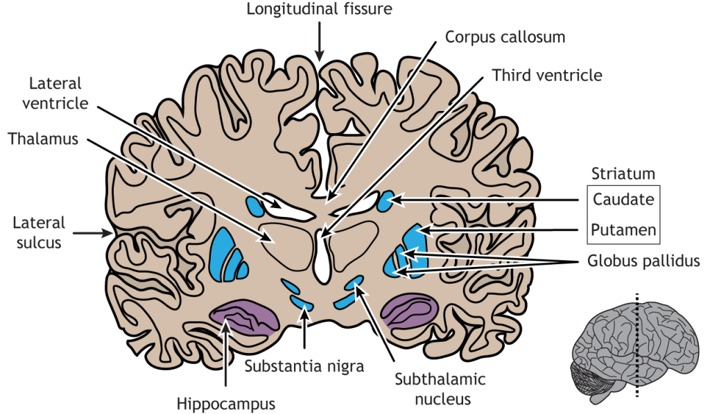 Coronal view of the hippocampus and basal ganglia. Details in text and captions.