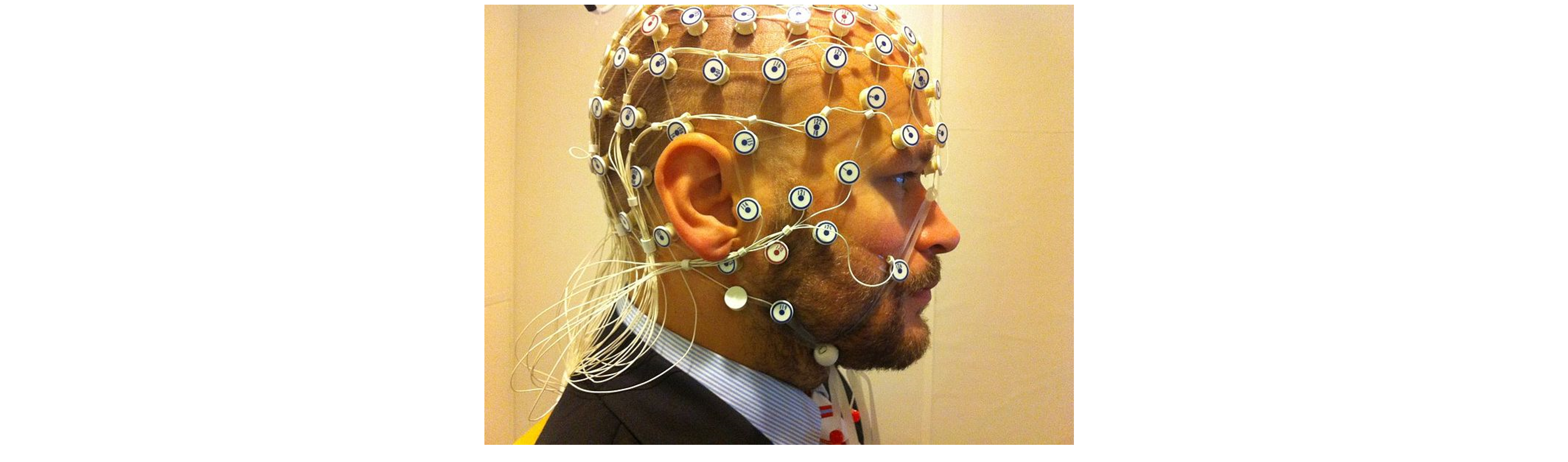 A man with EEG recording electrodes placed on the scalp.