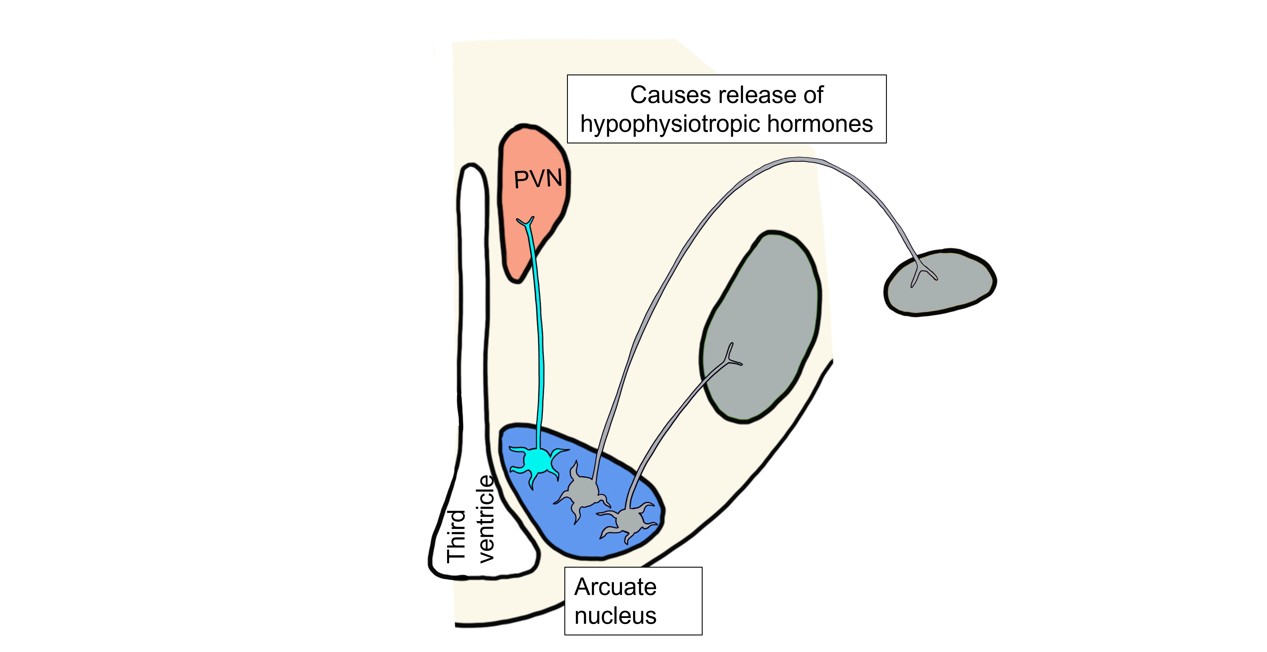 High leptin humoral response.