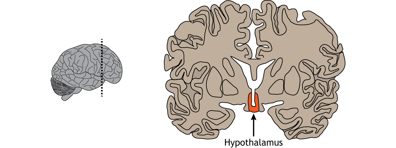 Illustration of a coronal section of the brain showing the location of the hypothalamus.