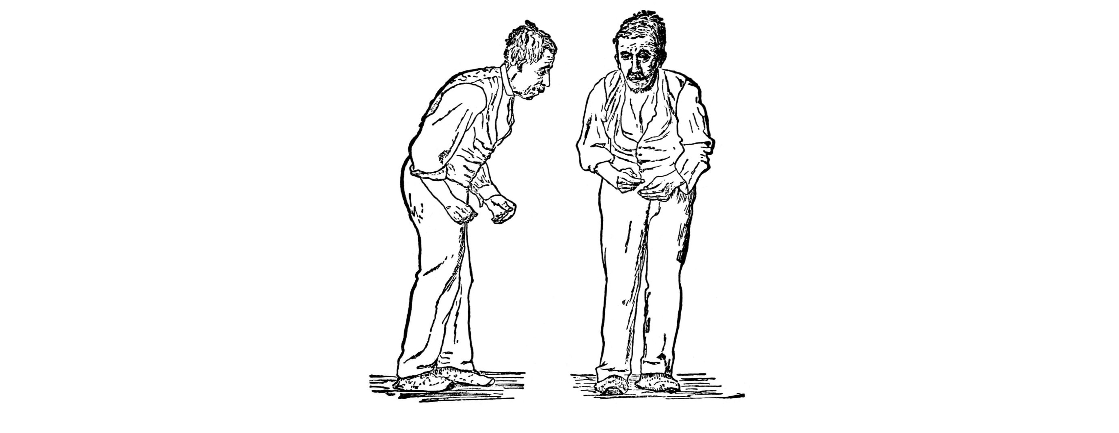 Image showing the stooped posture and shuffling gait of Parkinson's disease. Details in caption and text.