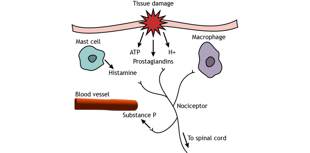 Illustration of inflammatory substances released during tissue injury.