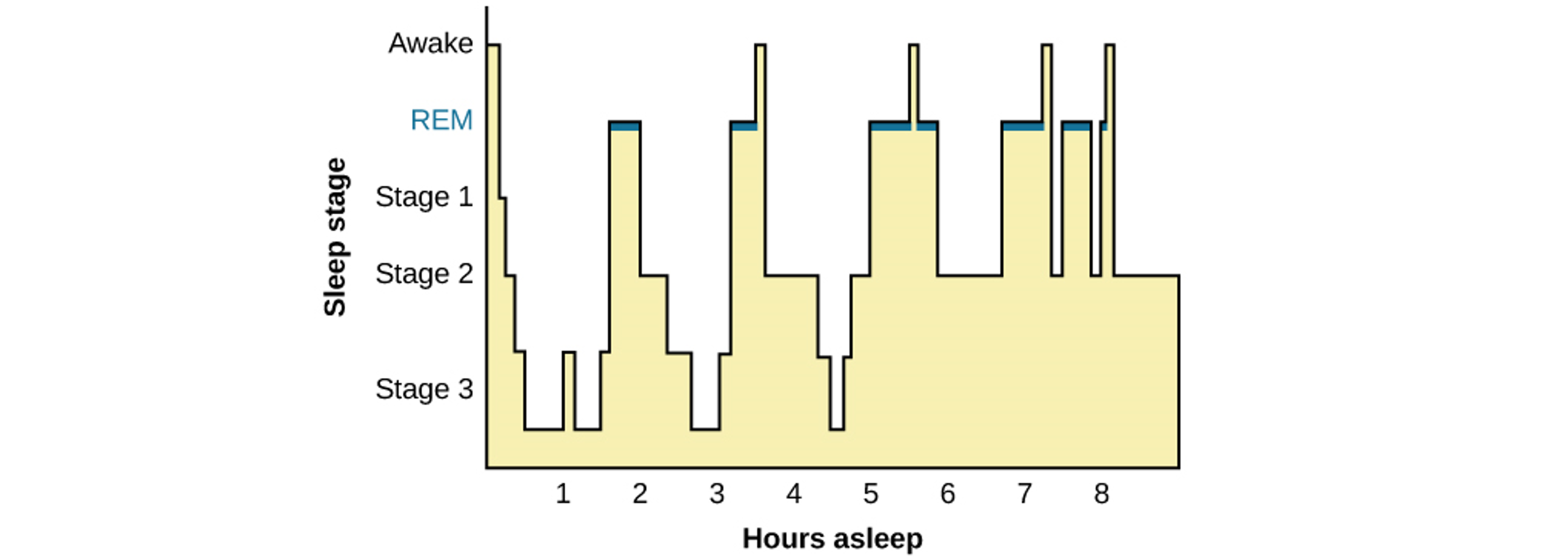 Hypnogram showing the progression of sleep stages throughout the night.