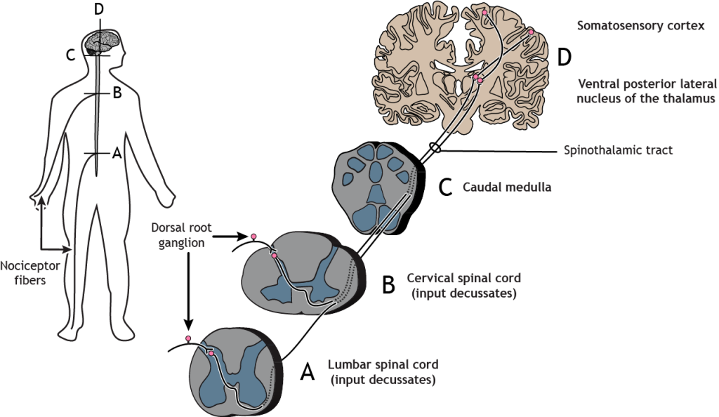 Illustrated pathway of the pain and temperature pathway from the nociceptor in the body to the somatosensory cortex.