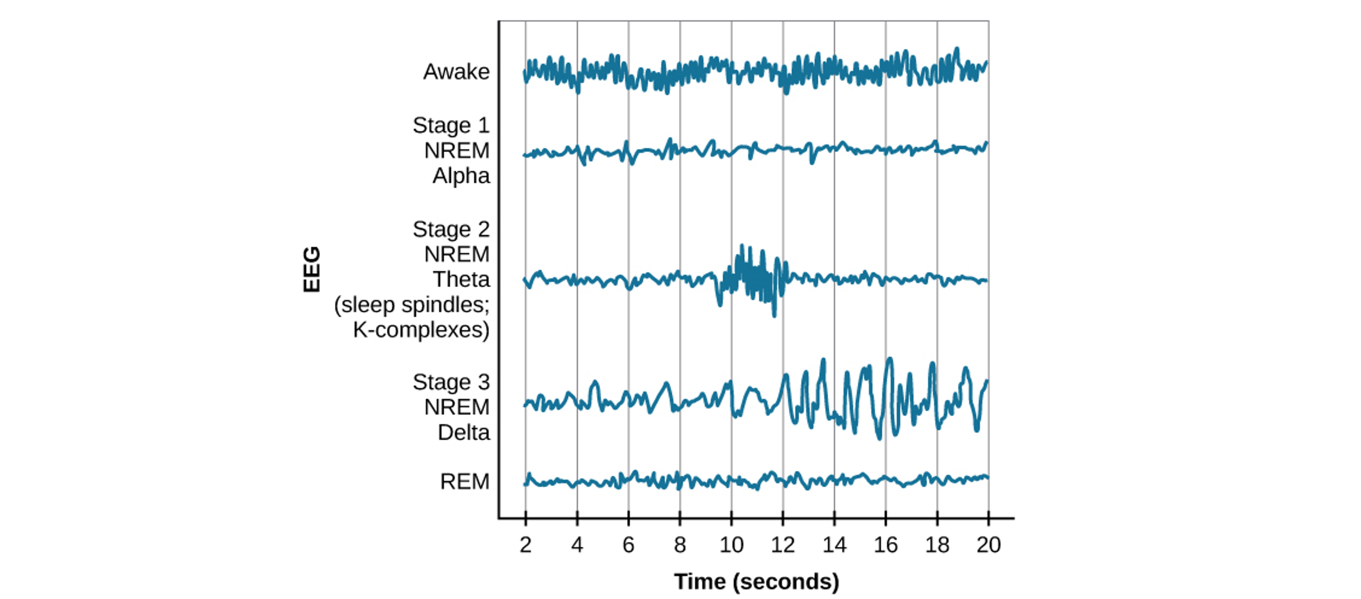 EEG activity during different stages of sleep.