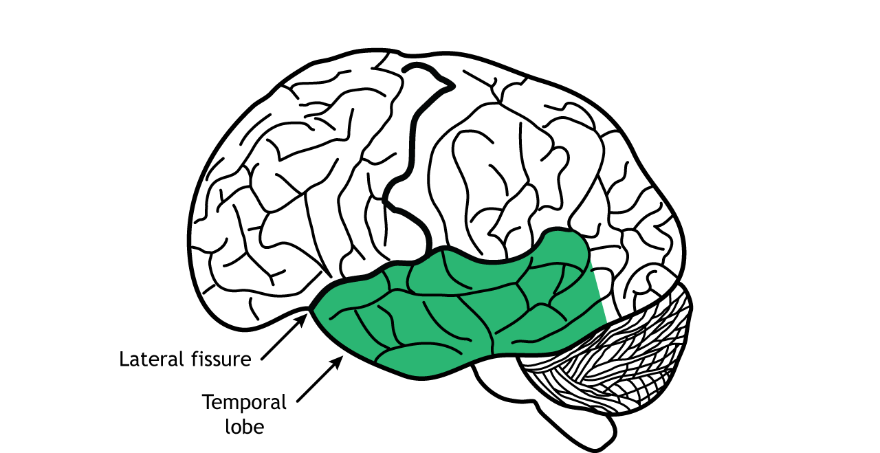 Illustration of the brain showing the temporal lobe.