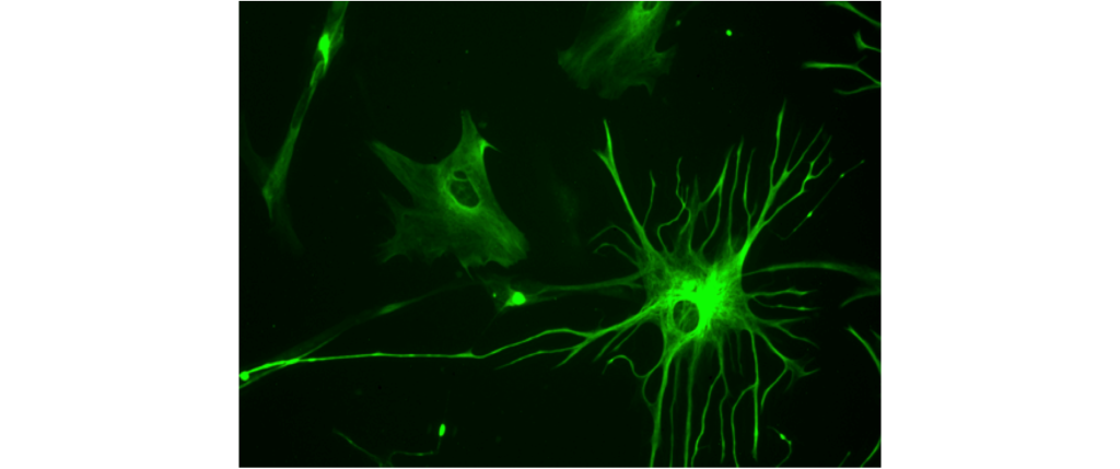 Astrocytes stained with fluorescent green marker