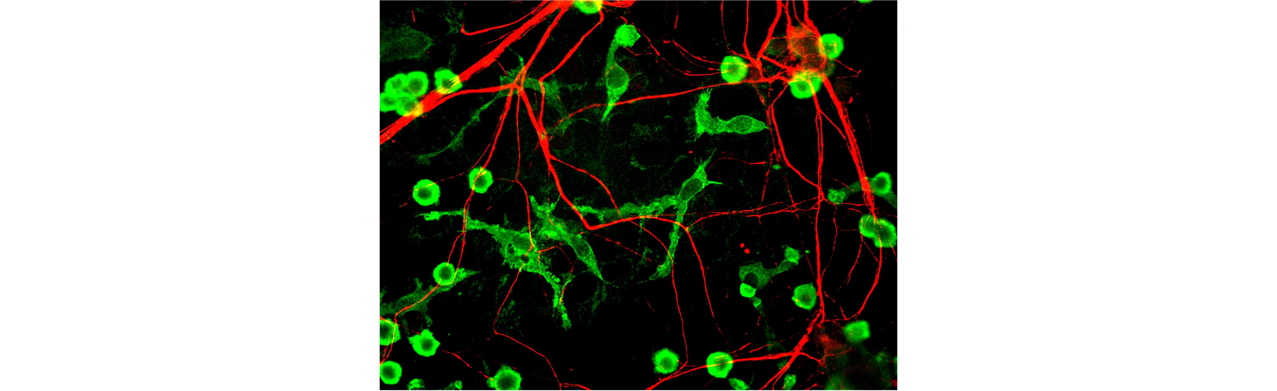 Photograph of microglia and neurons visualized with fluorescent stains. The microglia are much smaller than the neurons.