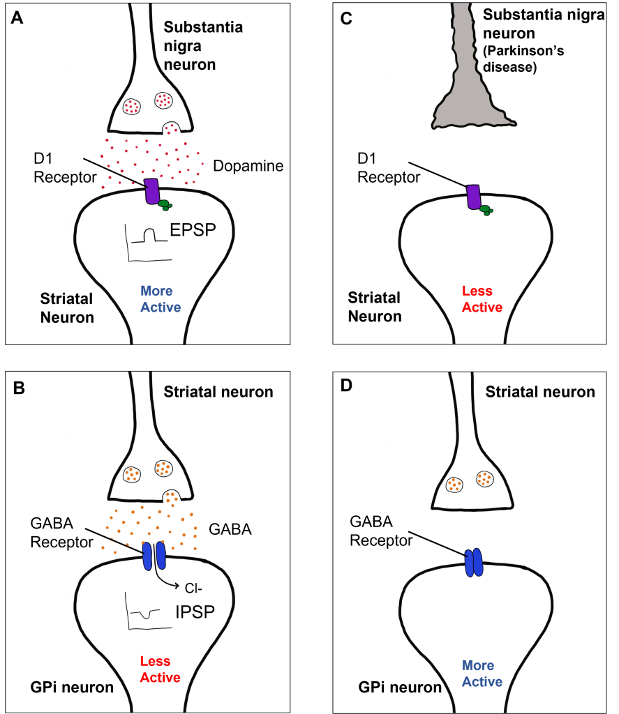 Comparison of how D1 receptor activation between healthy individuals and those with Parkinson's disease.