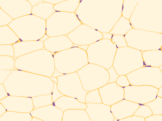 Illustration shows irregularly shaped cells with tiny nuclei clustered next to the cell's outer membrane.