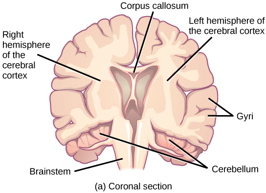 The coronal (front) of the human brain. The large upper part of the brain, called the cerebral cortex, is divided into left and right hemispheres. A cavity resembling butterfly wings exists between the left and right cortex. The corpus callosum is a band that connects the two hemispheres together, just above this cavity. The surface of the cerebral cortex contains bumpy protrusions called gyri. The cerebral cortex is anchored by the brain stem, which connects with the spinal cord. On either side of the brainstem tucked beneath the cerebral cortex is the cerebellum. The surface of the cerebellum is bumpy, but not as bumpy as the cerebral cortex.