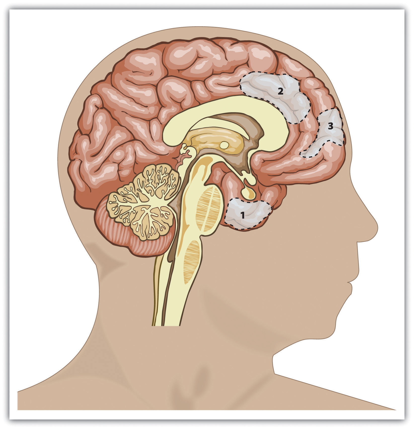 Diagram of the brain with 3 small areas highlighted.